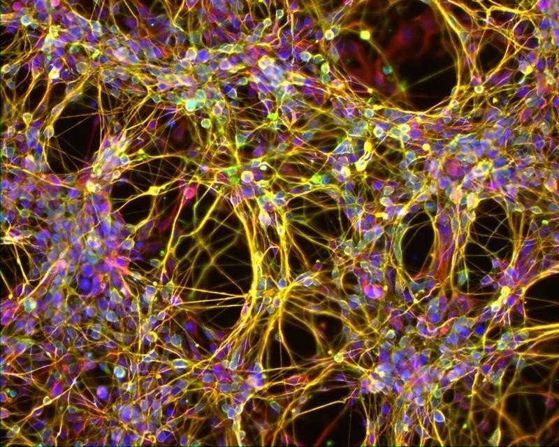 Человеческая клетка под микроскопом фото