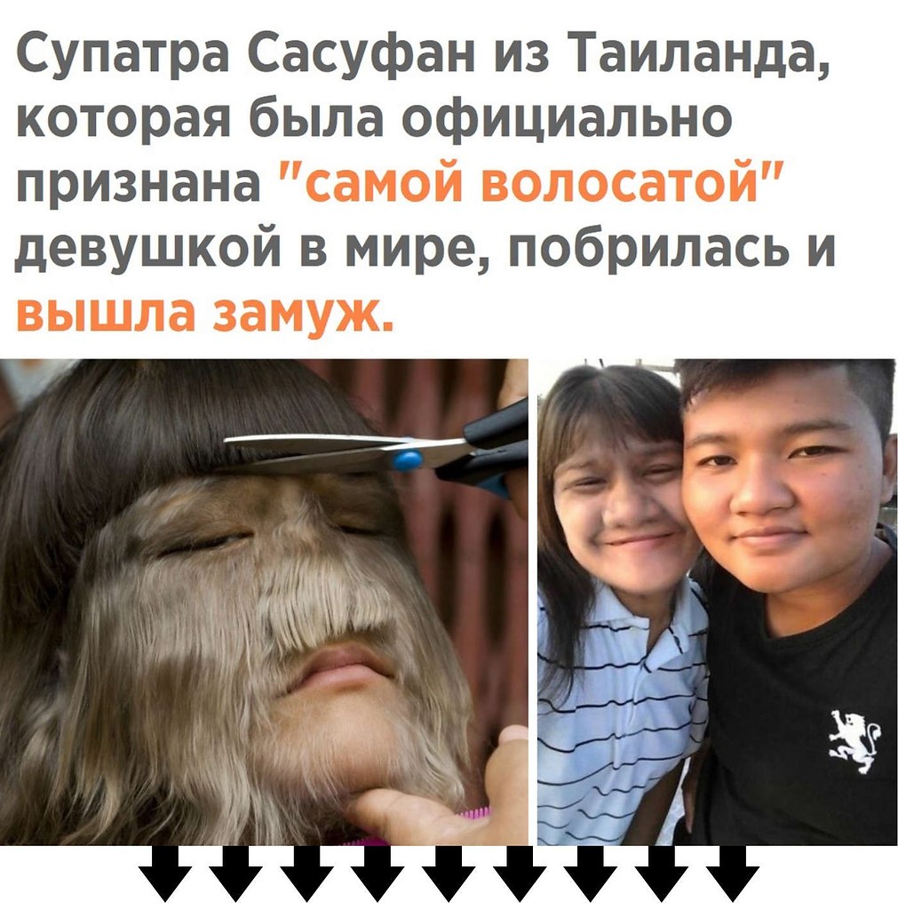 Самая Волосатая В Мире Фото