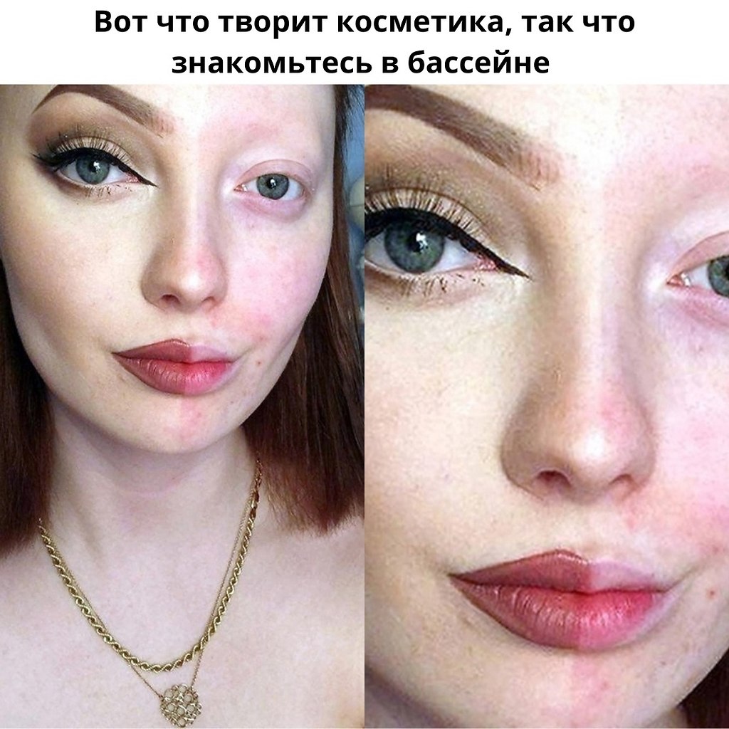 медицина творит чудеса хочешь в живую покажу