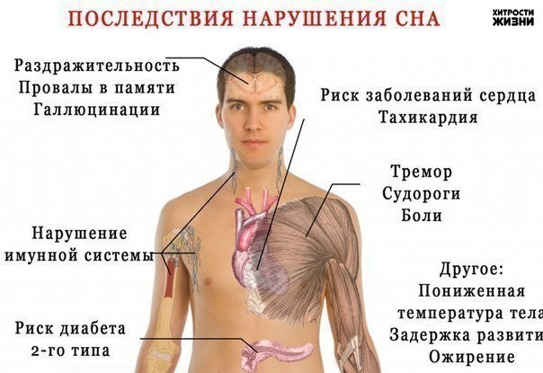 8 Последствий нарушения сна.Миллионы людей страдают нарушением сна и бессонницей. Если Вы можете ...