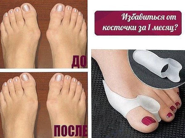   : http://fotostrana.ru/public/233467 ;-)    VALGUS PRO  ...