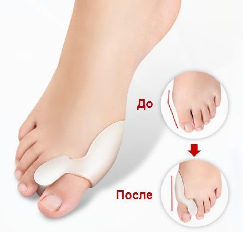 Valgus Pr - ee cpeco o ae oco!       ... - 6