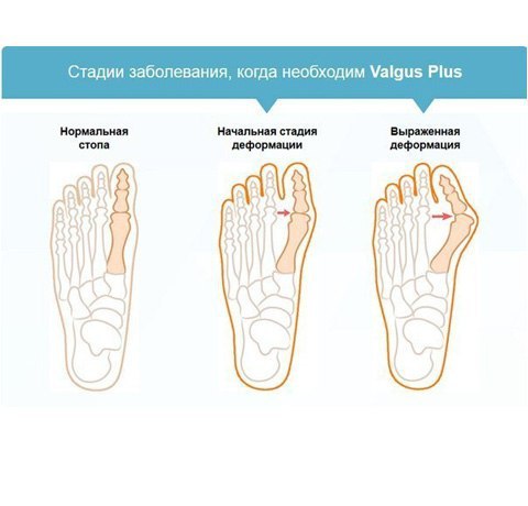 Valgus Pr - ee cpeco o ae oco!       ... - 3