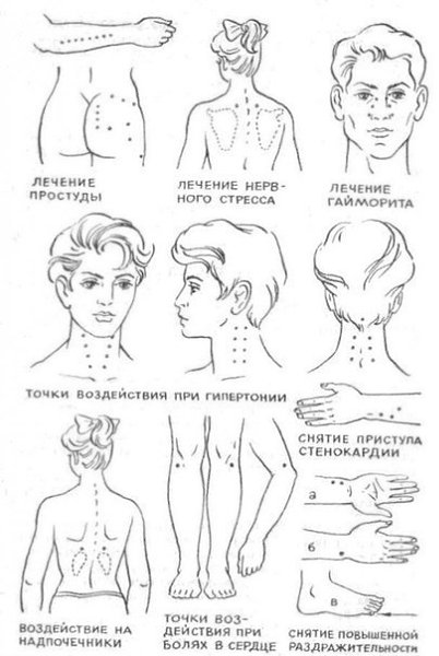 Точечный массаж - снимаем боль и помогаем организму - 2