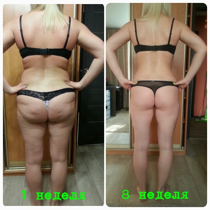        ViaFit 
