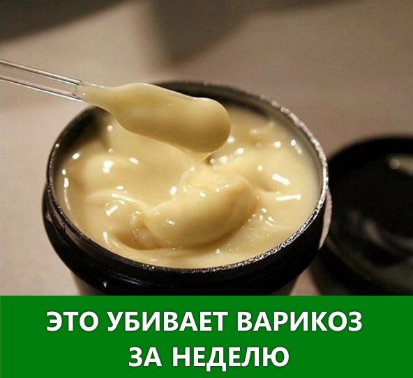 Как лечить варикоз дома? Варикоз некоторые женщины пытаются сравнить с чем-то вроде насморка. А ...