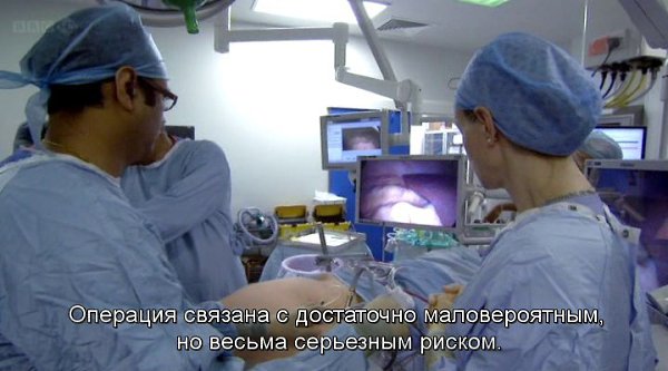 Правда об ожирении.(The Truth about Fat)Хирург Габриэль Вестон выясняет, почему столь много людей в ... - 2
