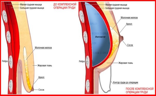 Грудь После Кормления Фото
