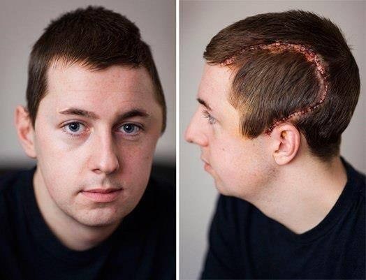 23-летний Льюис Годфри, попав под 15-тонный грузовик, пострадал от таких ужасных травм, что врачи ...