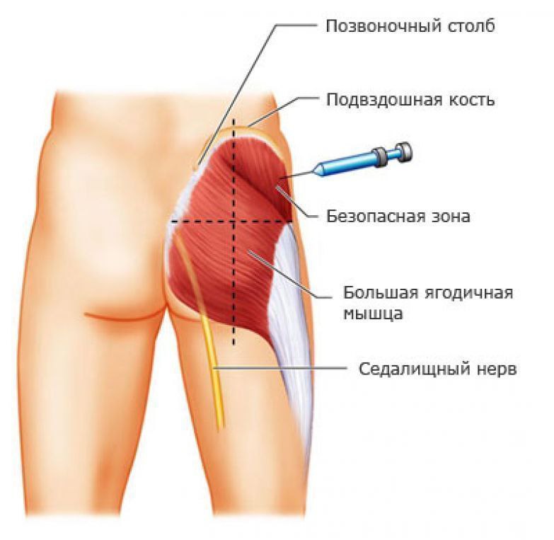 Уплотнения от уколов. Чем убрать?? - Советчица