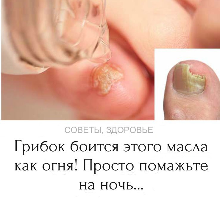  ee    oa x! o o  a o   ...