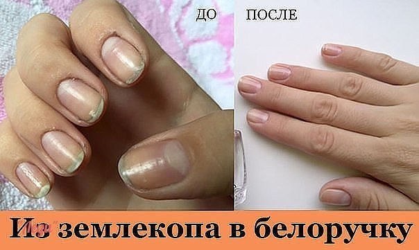 ПРОСТОЙ СПОСОБ СДЕЛАТЬ ИЗ ЗЕМЛЕКОПА - БЕЛОРУЧКУ! На просторах интернета я когда-то нашла донельзя ...