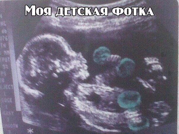 SportFeed - 1  2017  03:24