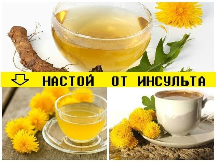 НАСТОЙ ОТ ИНСУЛЬТА.Когда два года назад я перенес инсульт, врачи не были уверены, что я когда-нибудь ...