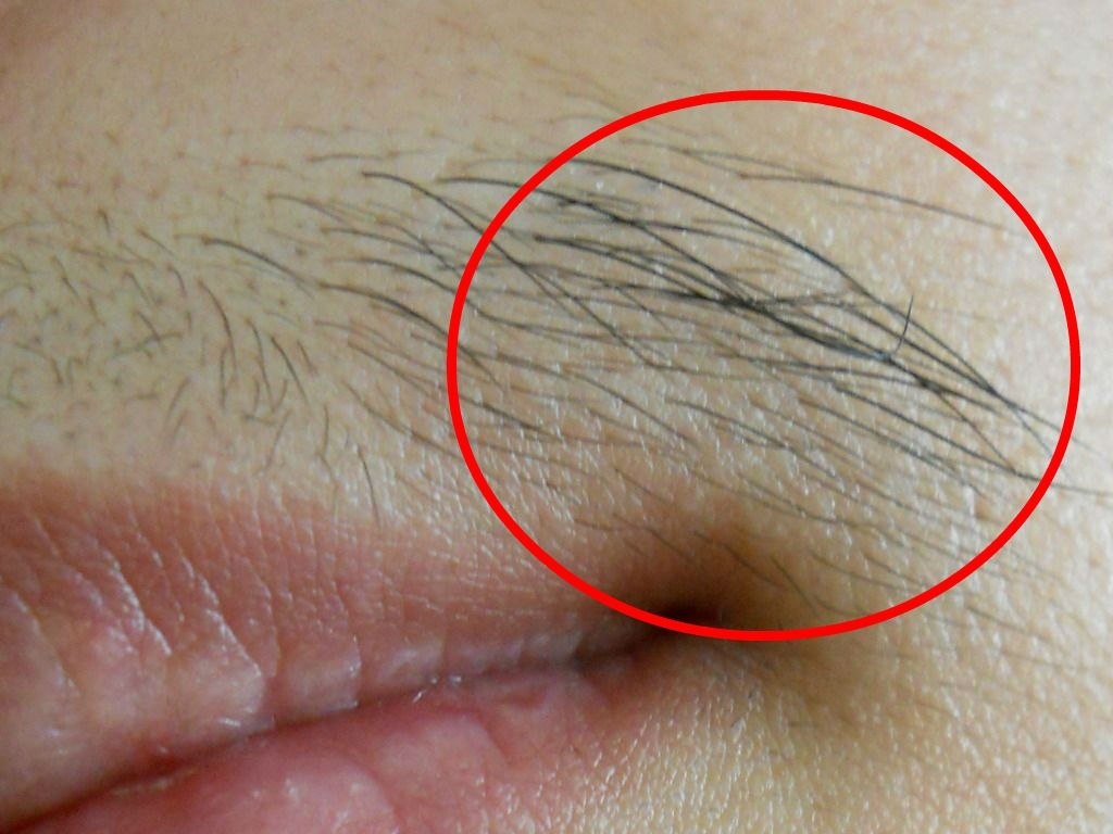    - 2