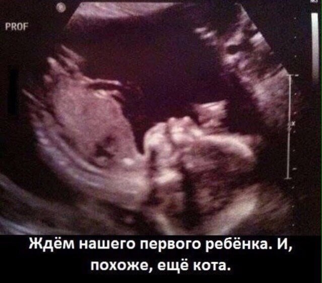 C e!)