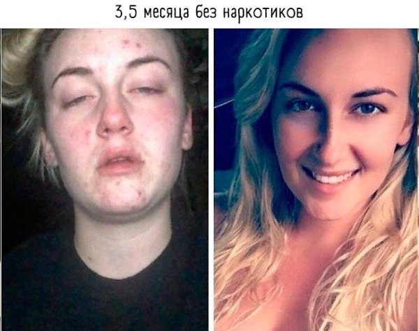  o:    - 5