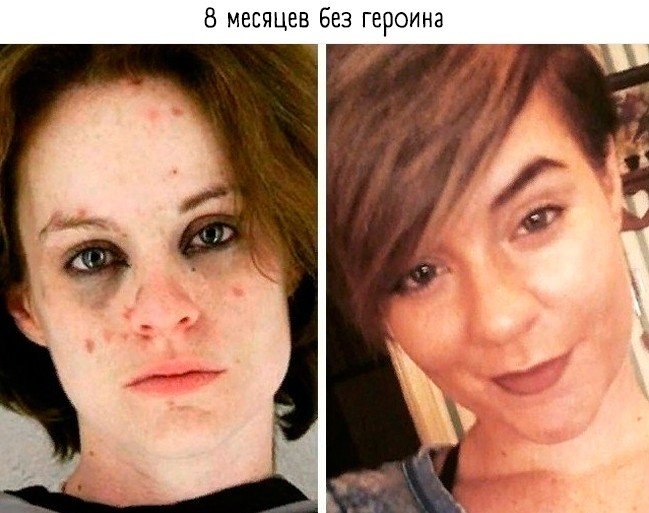  o:    - 4