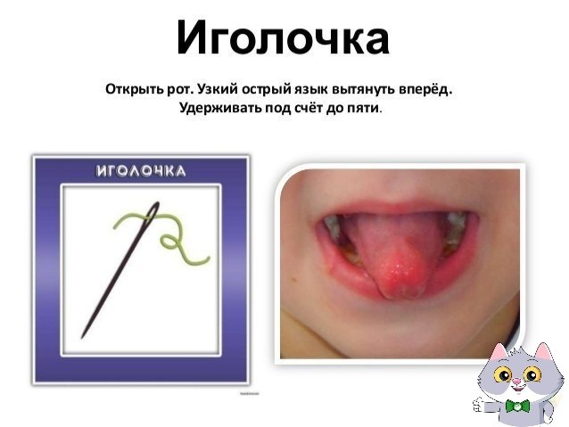    - 5