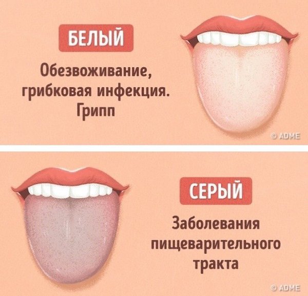 Как выявить проблемы со здоровьем по цвету языка: