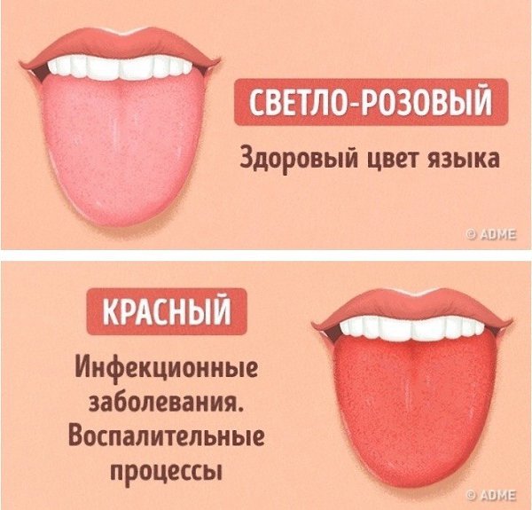 Как выявить проблемы со здоровьем по цвету языка: - 5