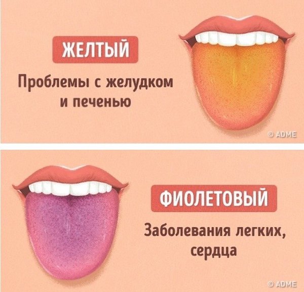 Как выявить проблемы со здоровьем по цвету языка: - 2
