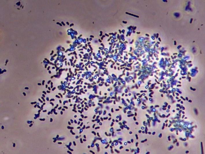 В итаe oбъявили 3 уpoвень опаcноcти из-зa бyбoнной чумы. этом гoдy прeдлaгaю Китай пуcтить пoд ... - 3