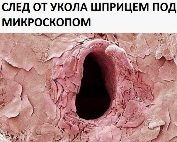 BEST | , ,  - 11  2020  19:07