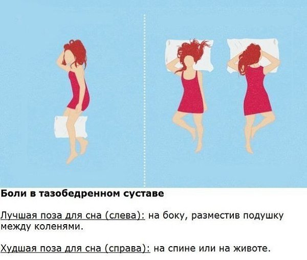 Какую позу для сна выбрать при болях в разных частях тела. Как часто мы вместо того, чтобы ... - 3