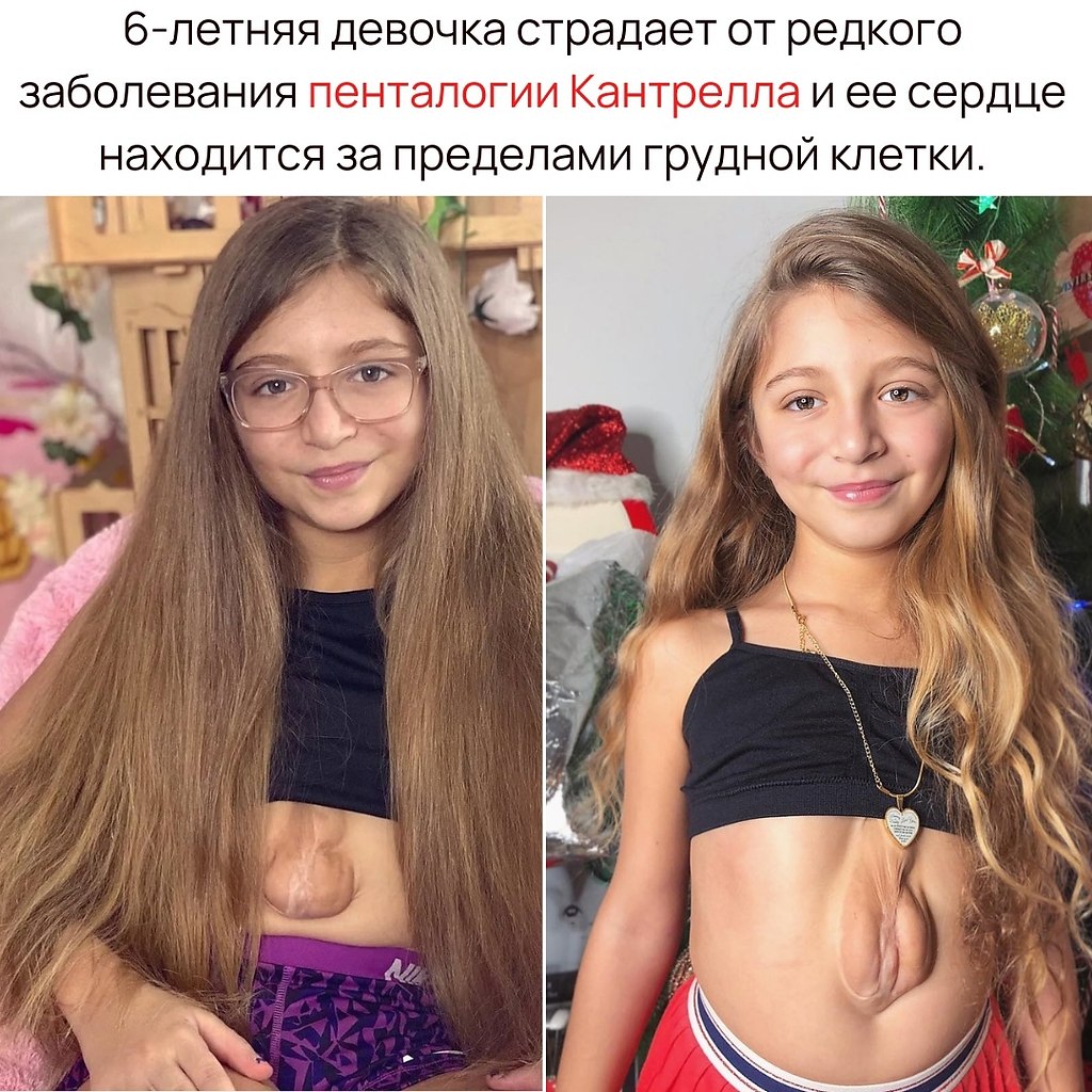        . - 2