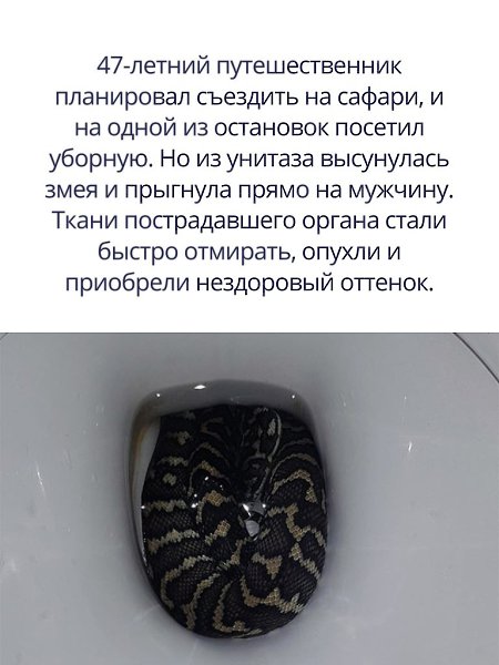 Мертвую ткань, однако, позже восстановили. Полностью восстановился мужчина только через год. - 2