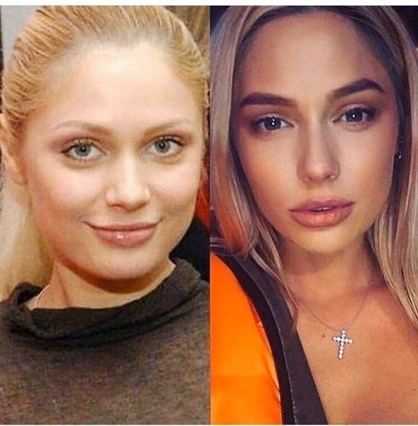         - 7