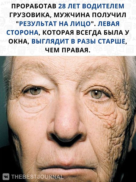 Если вы все ещё думаете, что солнечные лучи полезны, то у нас для вас плохие новости.Эти фото очень ...