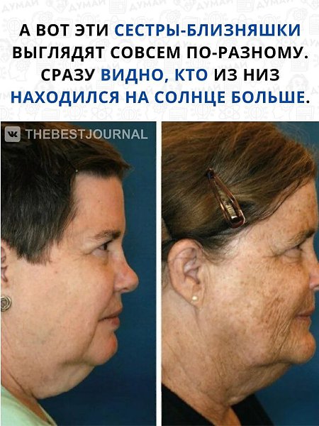 Если вы все ещё думаете, что солнечные лучи полезны, то у нас для вас плохие новости.Эти фото очень ... - 2