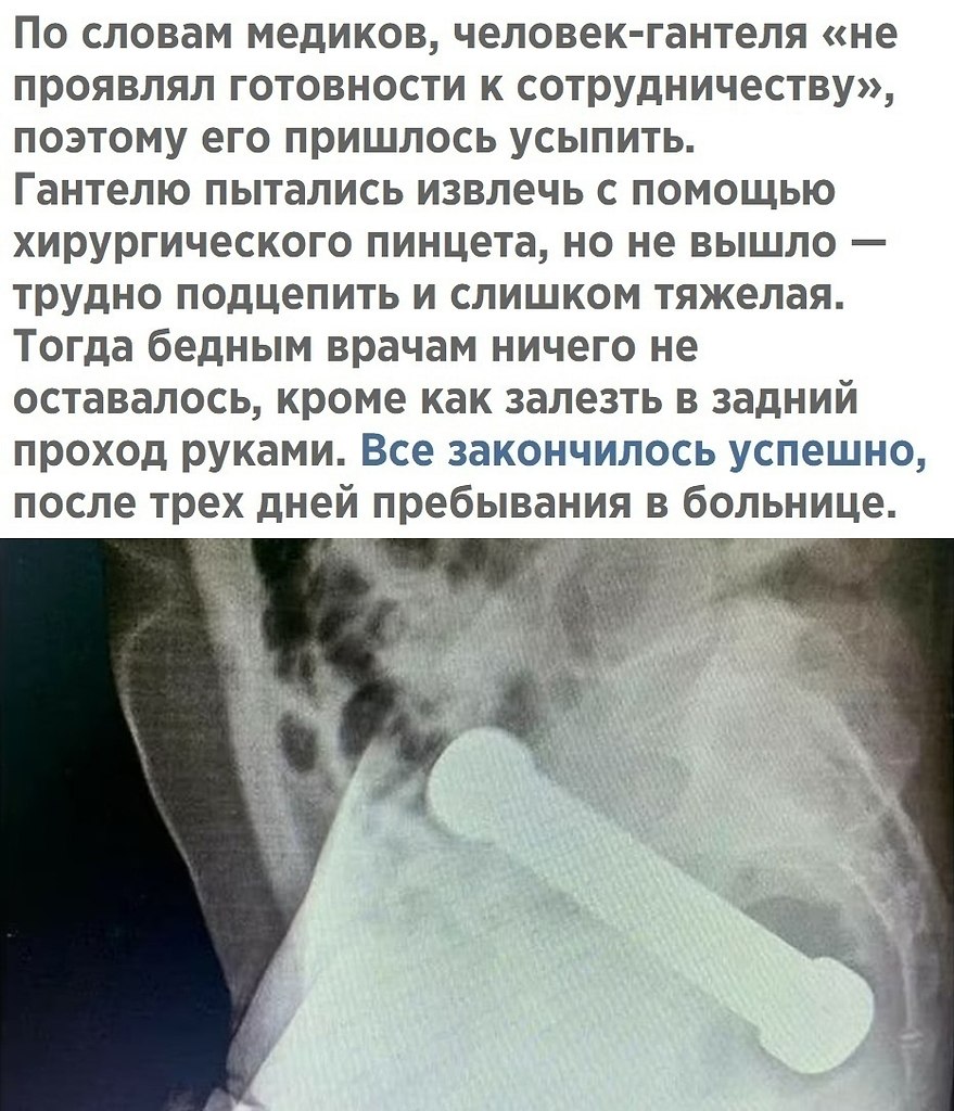 ,    - 3