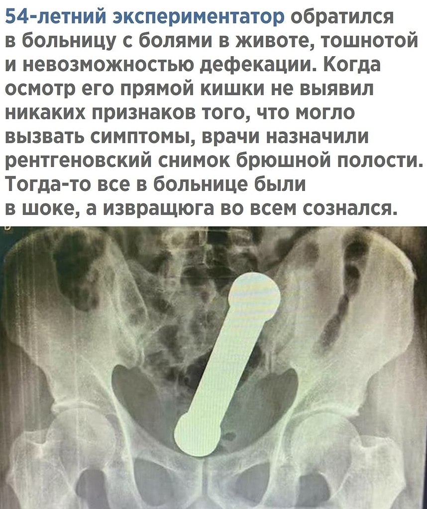 ,    - 2