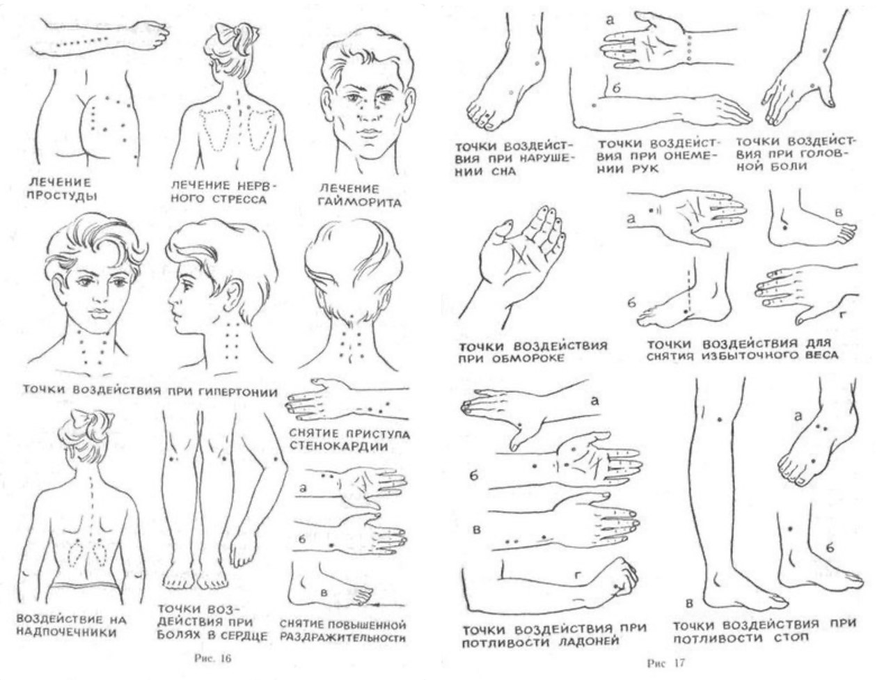 Активные точки на теле человека в картинках