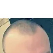 ������� ���������, 44 ����, �����������