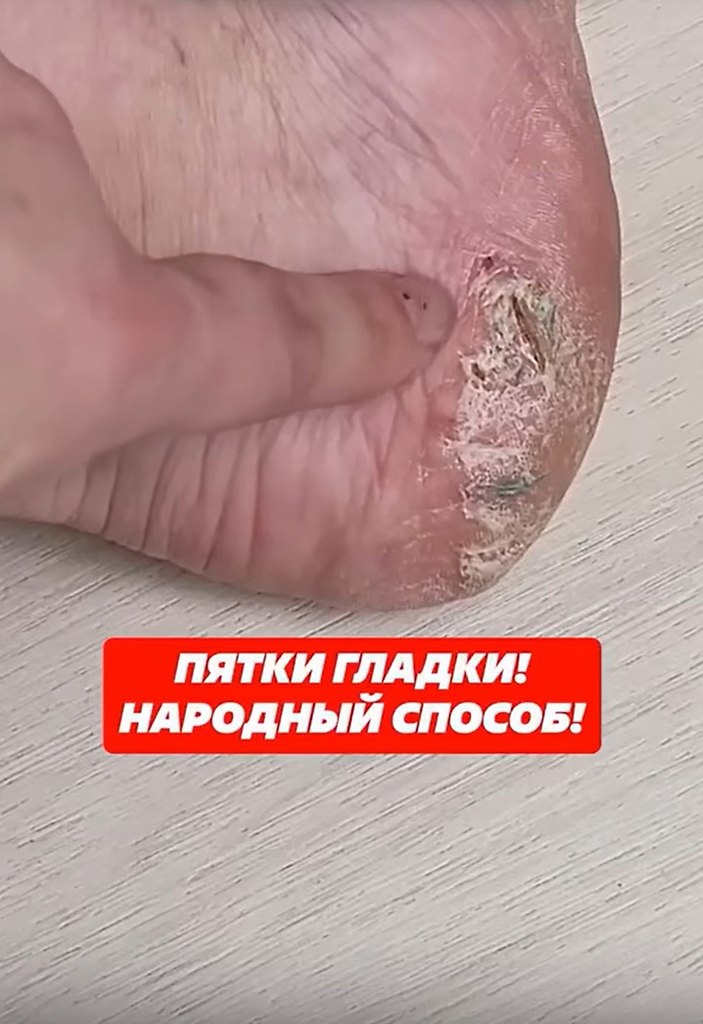            ! - 2