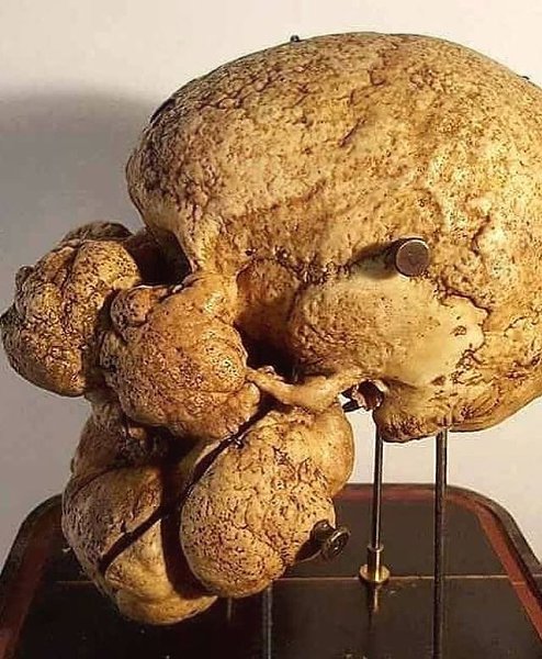 ����� �������� ����������� ��������� ������, ��� ������� ���������� ���������� ���� ������ ������ � ... - 2