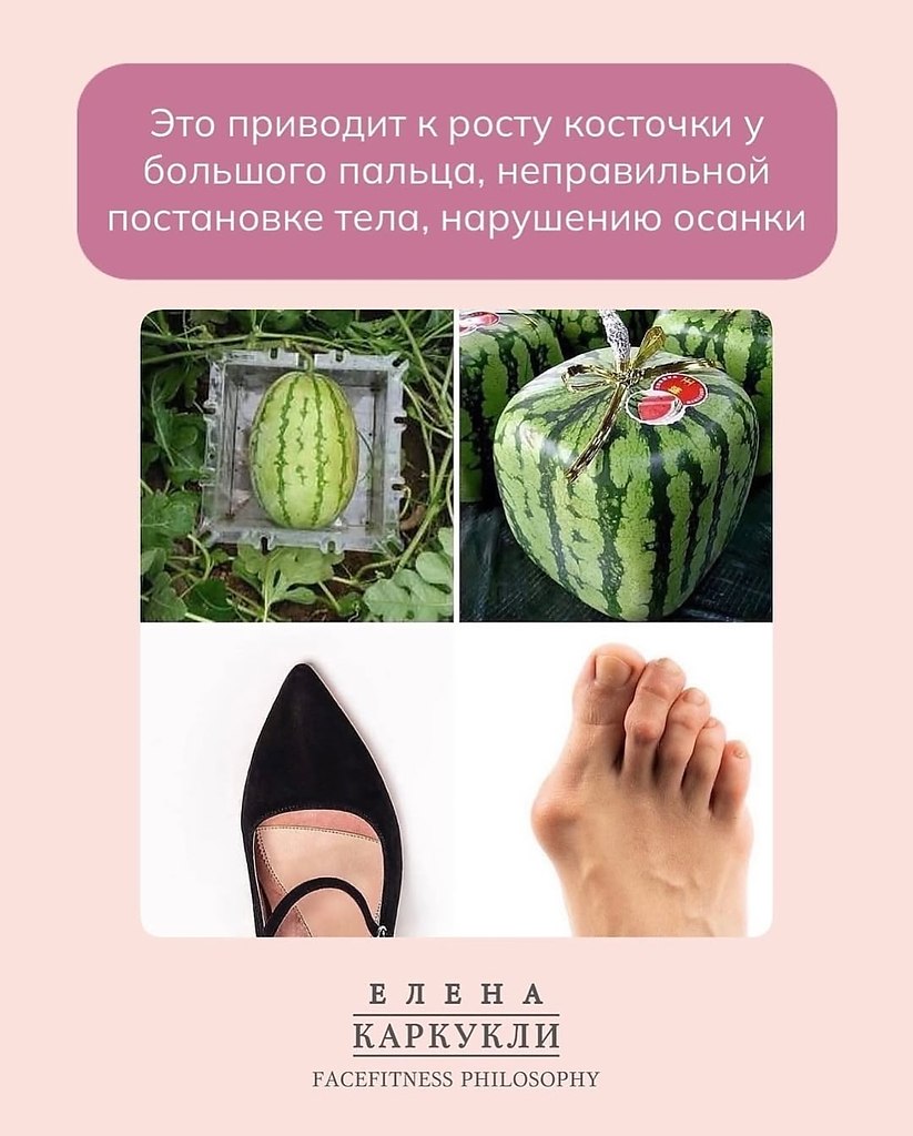 Деформация стоп есть почти у каждого человека! И чаще всего причина — обувь, которую мы носим каждый ... - 3