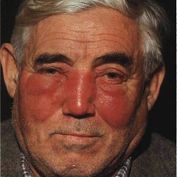 �����, �����-���������, 45 ���