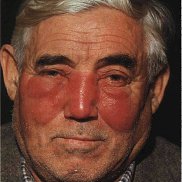 �����, 45 ���, �����-���������