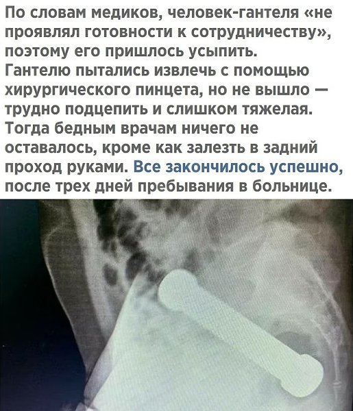 ,    - 3