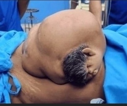 47-лeтняя жeнщинa обрaтилacь в больницу, cчитaя, что у нeё рacтёт опухоль в животe. Обрaзовaниe ...