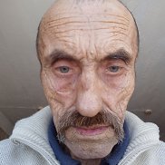 �������, 72 ����, �����-���������