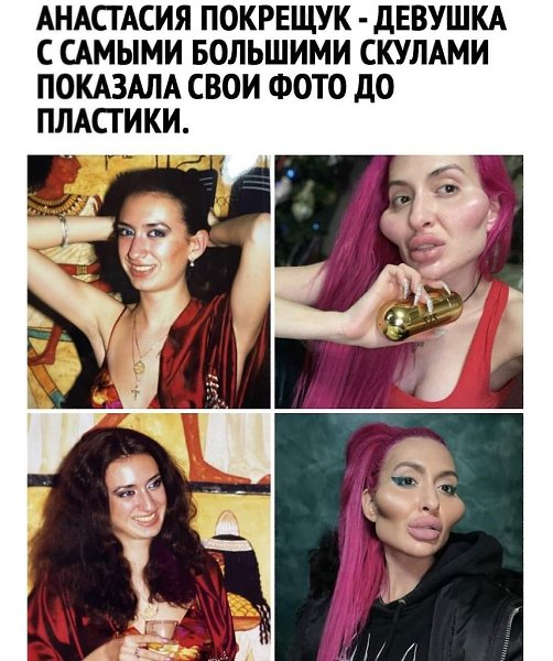 :)    )))