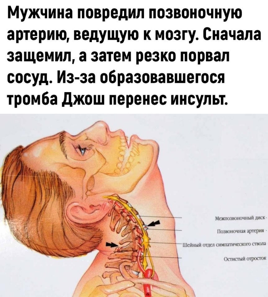Плюс фобия - 2