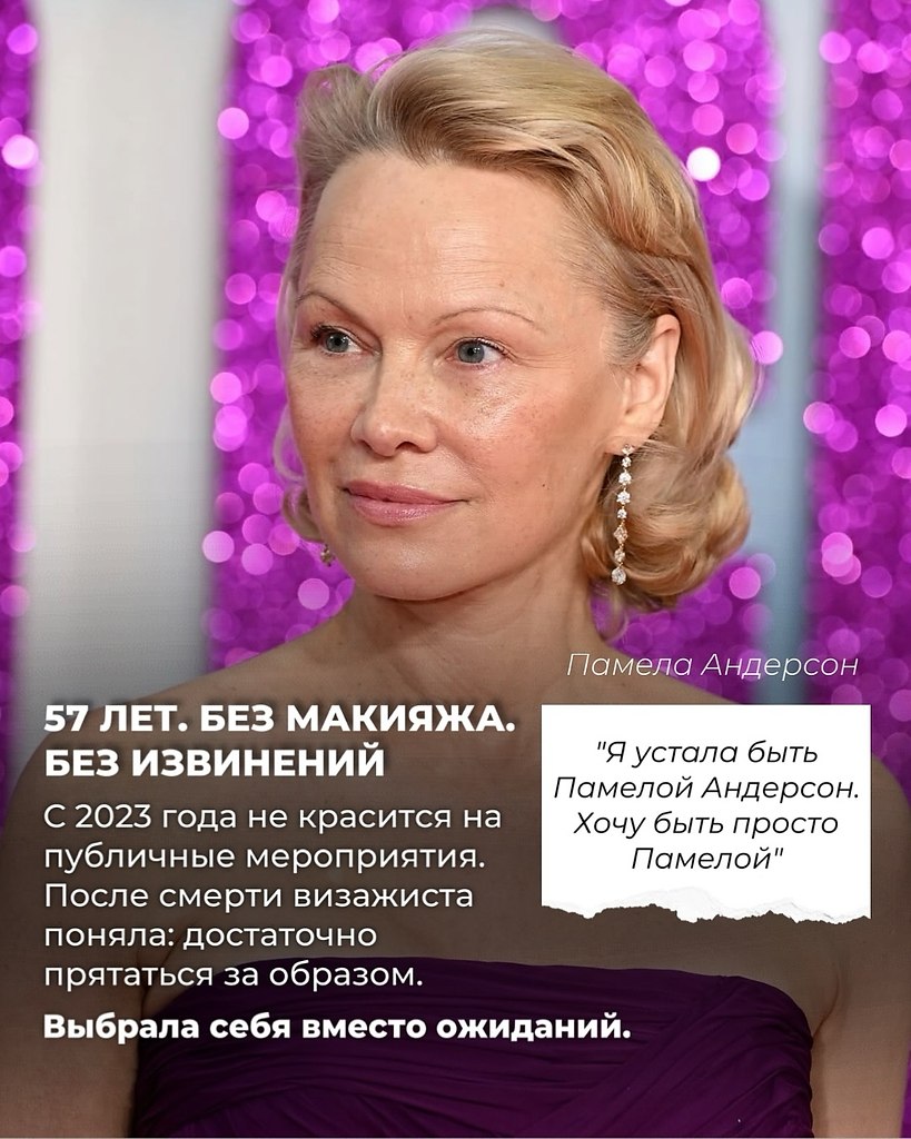 Они выбрали внутреннюю опору вместо внешней - 2