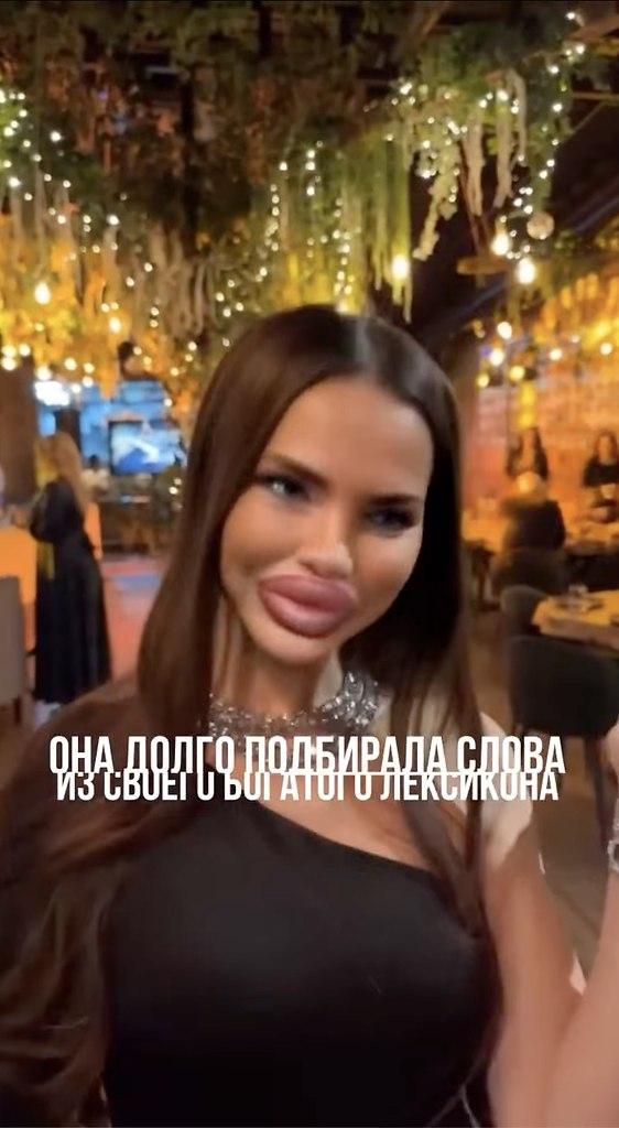   ? - 2